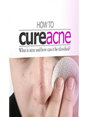 cover image of How to Cure Acne